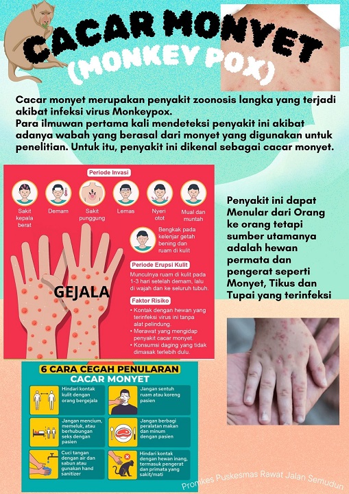 Cacar Monyet